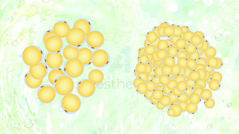 Слева - увеличенные в размерах жировые клетки; справа - клетки человека с нормальным ИМТ